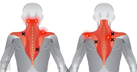 Pin On Shoulder Pain Relief