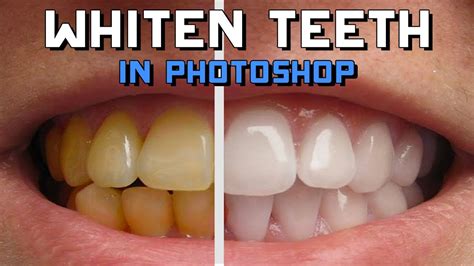 How To Whiten Yellow Teeth In Adobe Photoshop Quick And Easy Youtube