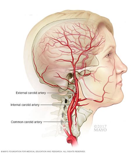 Carotid artery, one of several arteries that supply blood to the head and neck. Carotid artery disease Disease Reference Guide - Drugs.com