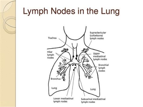 Lung Cancer Staging Paratracheal Lymph Node