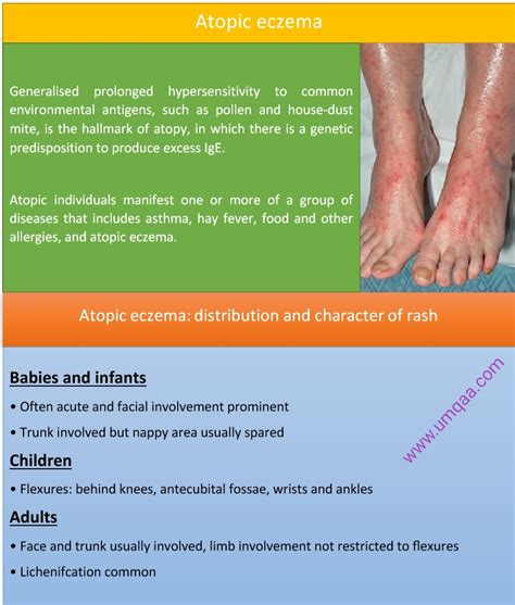 What Are The Diagnostic Criteria For Atopic Eczema