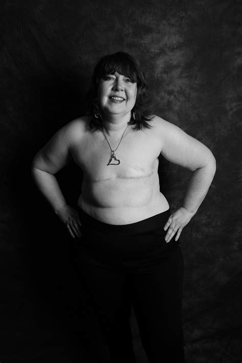 Women Bare Mastectomy Scars In Empowering Photos To Raise Breast Cancer