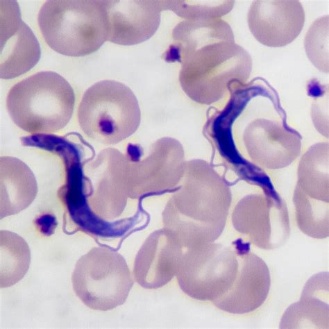 Common Infections Parasites Without Borders