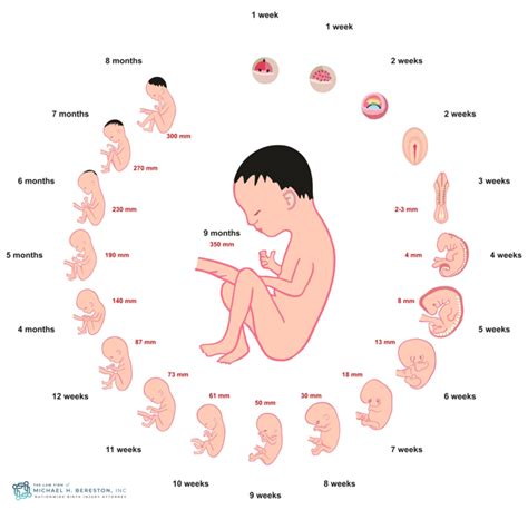 Premature Labor Injury Attorney The Law Firm Of Michael H Bereston