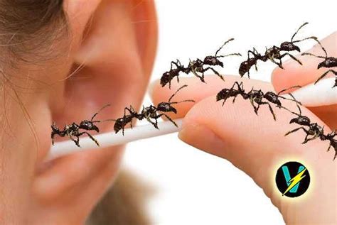 1000 giant ants removed from girl s ears—they just keep on breeding ants ear girl