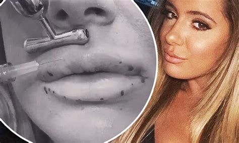 kim zolciak s daughter brielle gets lip fillers by kylie jenner s doctor daily mail online