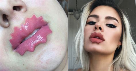 Devil Lips The New Trend You Wish You Never Heard Of Ready Set Beauty