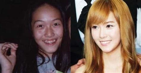 K Pop Female Idols Before And After Plastic Surgery