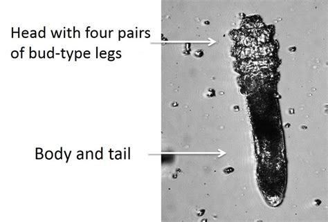 Figure 1 Demodex Confocal Microscopy Demodex Mites