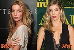 Annabelle Wallis Before and After Rhinoplasty | Annabelle wallis, Nose ...