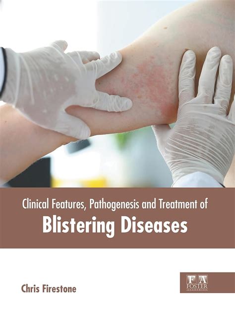 Clinical Features Pathogenesis And Treatment Of Blistering Diseases