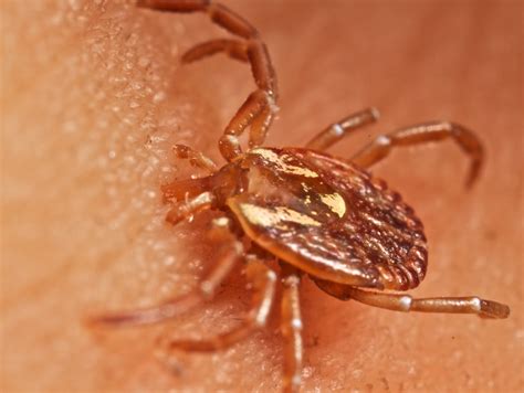 Tick Embedded In Skin Amblyomma Sp Thanks Sean For The Flickr