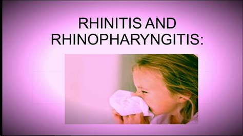 Rhinitis And Rhinopharyngitis Pedatrics Youtube