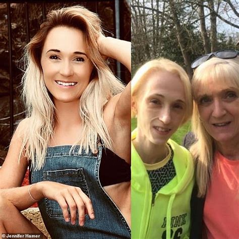 Jennifer Hamer Who Fell Into The Grips Of Anorexia For 17 Years Reveals
