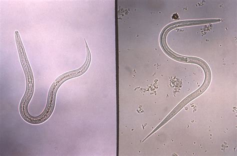 Public Domain Picture This Micrograph Depicts A Hookworm Lt And A