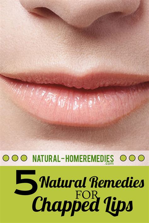 Five Natural Remedies For Chapped Lips Natural Home Remedies