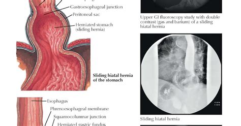 Pediagenosis