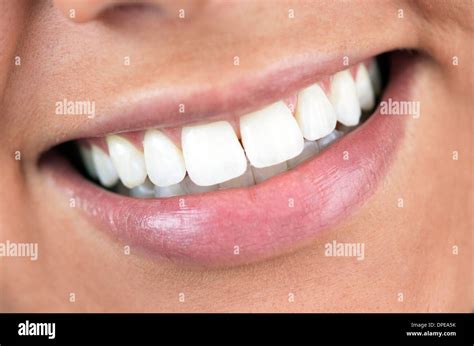 Perfect Teeth Hi Res Stock Photography And Images Alamy