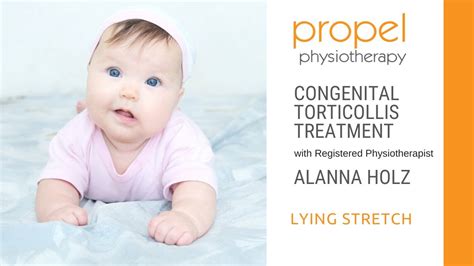 congenital torticollis treatment lying neck stretch propel physiotherapy youtube
