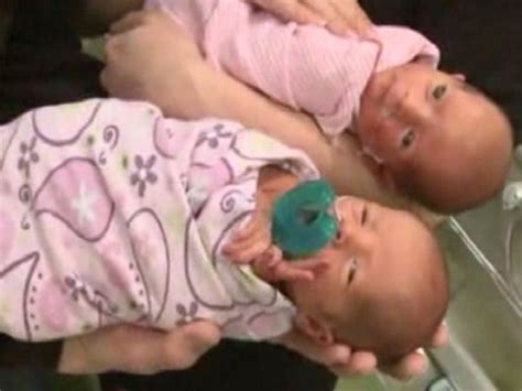 Woman Gives Birth To Rare Set Of Twins Didnt Know She Was Pregnant