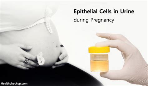 Increased wbcs in urine is seen in: Epithelial Cells in Urine During Pregnancy - Causes, Types ...