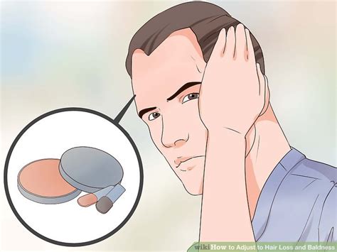 3 Ways To Adjust To Hair Loss And Baldness Wikihow Health