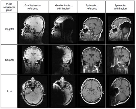 A three plane localizer must be taken in the beginning to localise and plan the sequences. Figure 10 The MRI images in three orthogonal planes ...