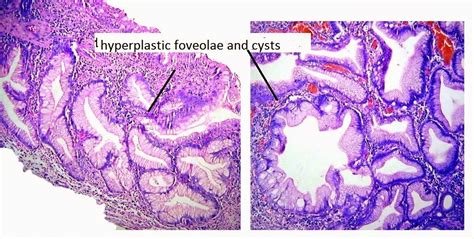 Gastrointestinal And Liver Histology Pathology Atlas Stomach