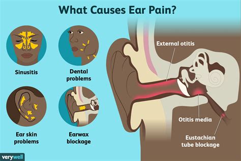 Ear Pain Causes Treatment And When To See A Doctor