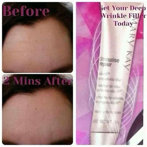 New Timewise Volu Fill Deep Wrinkle Filler For Instant Gradification