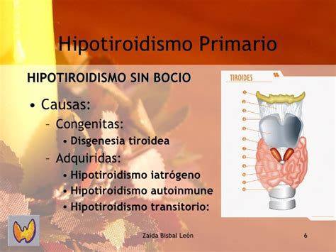 Hipotiroidismo Primario Autoinmune Seo Positivo