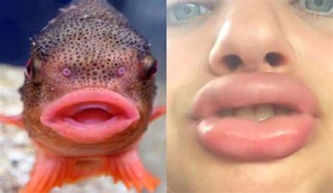 Kylie Jenners Lip Challenge Is Giving Girls Fish Lips 14 Pics