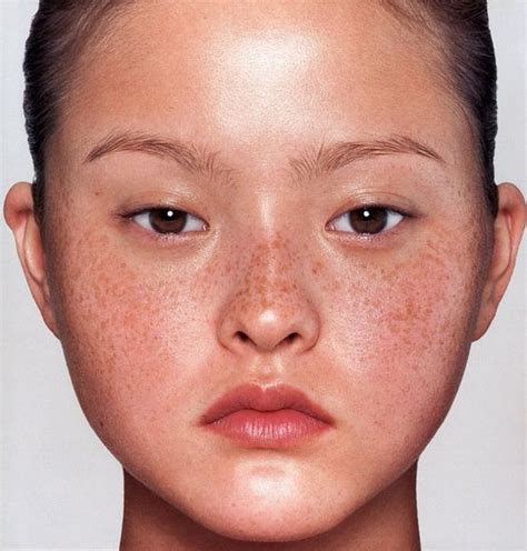Brown Spots On Face Brown Spots And Spots On Face On Pinterest