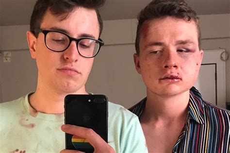 gay couple assaulted robbed on u street in attack that used homophobic slur police report says