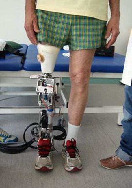 World S First Bionic Legs Presented English Ansa It
