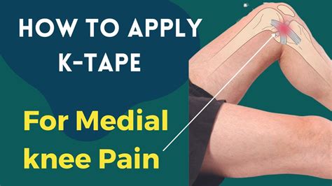 How To Treat Knee Pain Medial Collateral Ligament Mcl Kinesiology