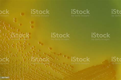 Vibrio Cholerae Bacterial Colonies On Tcbs Selective Medium Agar Stock