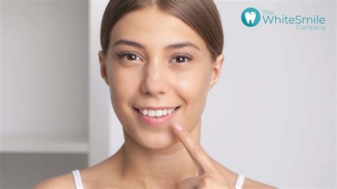 Smile Makeover 101 How Professional Teeth Whitening Transforms Your Appearance