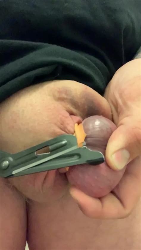Band Removal From Testicle Thisvid Com