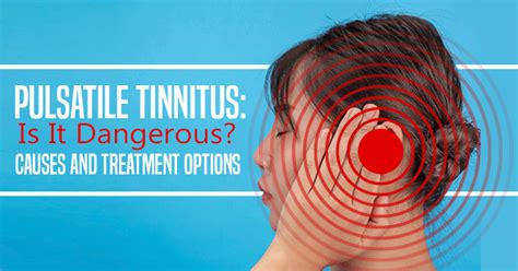 Pulsatile Tinnitus Causes Treatment Options