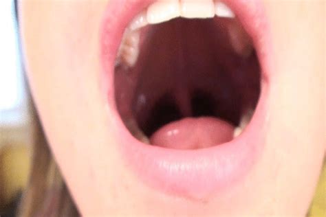 Mouth Fetish Dental Video With Diana Tongue Teeth Vore Yawning My XXX