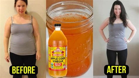 The Best Apple Cider Vinegar Weight Loss Results Best Recipes Ideas