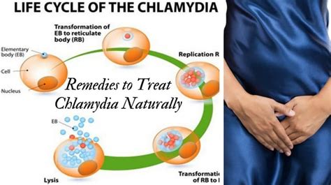 chlamydia as related to rid pictures