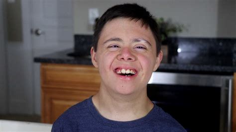 Living With Down Syndrome And Dwarfism Also Legally Blind Miguel Is