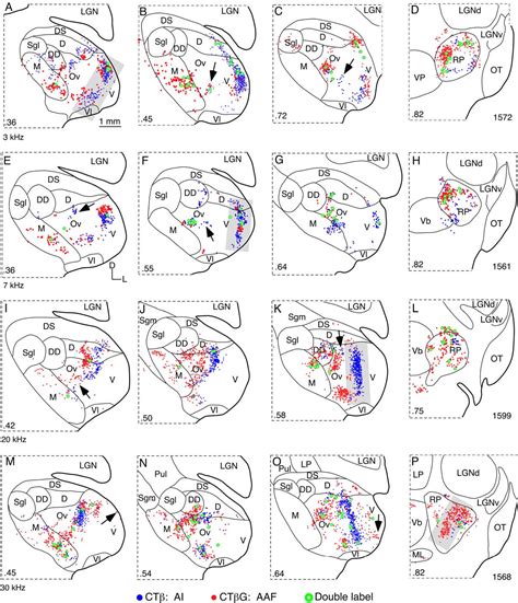 Figure 2 From Tonotopic And Heterotopic Projection Systems In