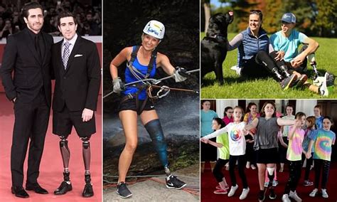 Boston Marathon Bombing Amputee Survivors Inspire Remarkable