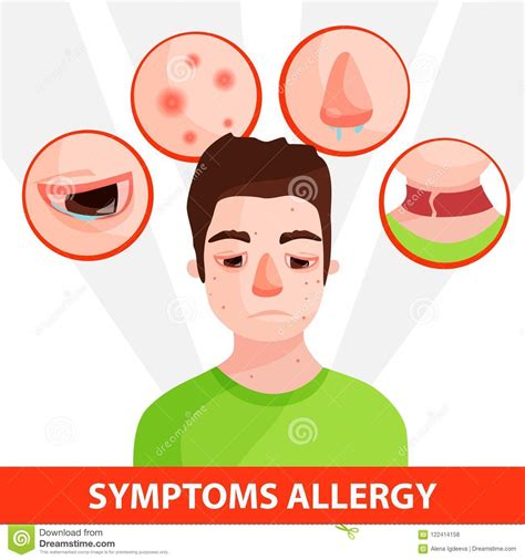 Allergy Infographic Stock Vector Illustration Of Symptoms 122414158