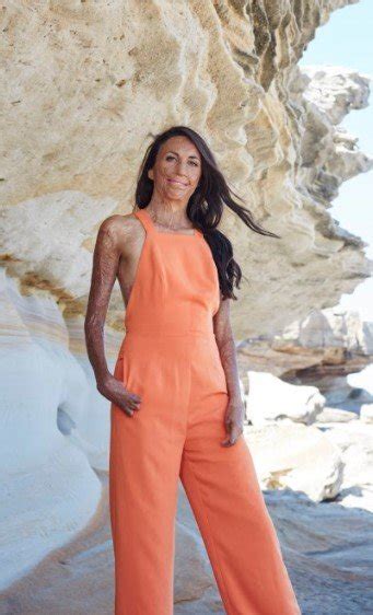 Turia Pitt Unmasked Book Photos Turia Pitt