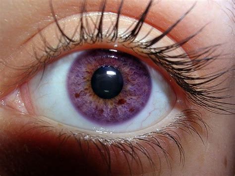 Purple Eyes Real Life
