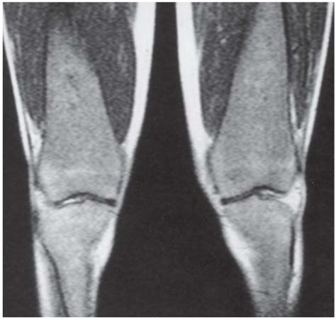 Knee Radiology Key